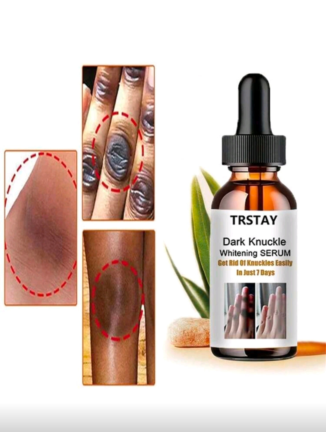 100ml Hydrating Facial Essence – Deeply Lock In Moisture, Reveal Translucent Radiance