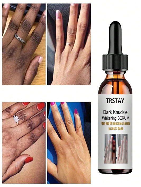 100ml Hydrating Facial Essence – Deeply Lock In Moisture, Reveal Translucent Radiance